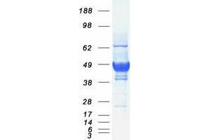 Validation with Western Blot