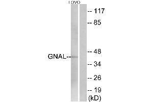 Immunohistochemistry analysis of paraffin-embedded human brain tissue using GNAL antibody. (GNAL anticorps  (Internal Region))