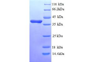 Annexin A3 (ANXA3) (AA 5-322), (partial) protein (His tag)