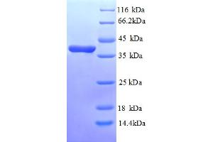 SDS-PAGE (SDS) image for Annexin A3 (ANXA3) (AA 5-322), (partial) protein (His tag) (ABIN5713074) (Annexin A3 Protein (ANXA3) (AA 5-322, partial) (His tag))