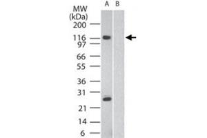 Western blot analysis of SIK2 in human brain in the A) absence and B) presence of immunizing peptide, using SIK2 polyclonal antibody  at 2 ug/mL . (SIK2 anticorps  (AA 100-150))