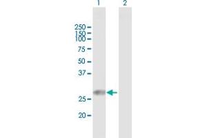 Western Blot analysis of TPD52L2 expression in transfected 293T cell line by TPD52L2 MaxPab polyclonal antibody.