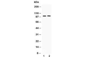 Western blot testing of 1) rat lung and 2) human PANC1 lysate with PDE5A antibody at 0. (PDE5A anticorps  (AA 20-63))