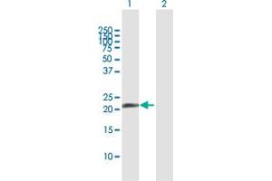Western Blot analysis of PDE4DIP expression in transfected 293T cell line by PDE4DIP MaxPab polyclonal antibody.
