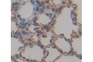 Used in DAB staining on fromalin fixed paraffin- embedded Kidney tissue
