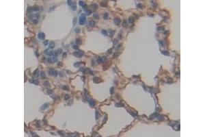 Used in DAB staining on fromalin fixed paraffin- embedded Kidney tissue (NOTCH4 anticorps  (AA 1690-1945))