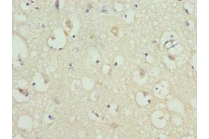 Immunohistochemistry of paraffin-embedded human brain tissue using ABIN7157743 at dilution of 1:100 (KCNIP2 anticorps  (AA 1-90))