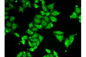 Immunofluorescence analysis of HeLa cells using ATXN3 antibody.
