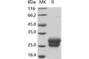 Frizzled Family Receptor 4 (FZD4) protein (His tag)