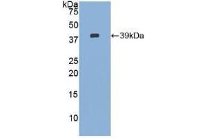 Western blot analysis of recombinant Human CVL. (Ezrin anticorps  (AA 1-295))