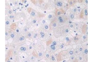 IHC-P analysis of Human Liver Tissue, with DAB staining. (APPL1 anticorps  (AA 404-673))