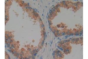 IHC-P analysis of Human Prostate Tissue, with DAB staining. (Proteoglycan 4 anticorps  (AA 1151-1241))