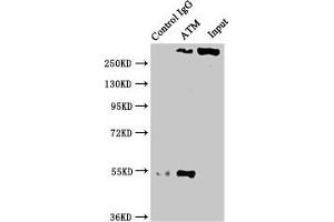 Immunoprecipitating ATM in PC3 whole cell lysate Lane 1: Rabbit control IgG instead of ABIN7127350 in PC3 whole cell lysate. (Recombinant ATM anticorps)