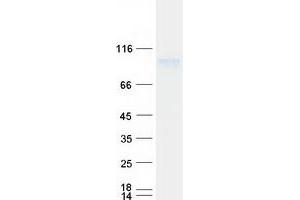 Validation with Western Blot