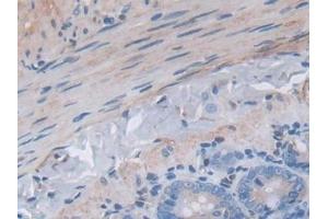 Detection of JNK1 in Rat Small intestine Tissue using Polyclonal Antibody to c-Jun N-terminal Kinase 1 (JNK1)