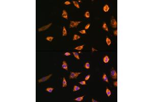 Immunofluorescence analysis of L929 cells using SPRR3 Rabbit pAb (ABIN6130714, ABIN6148386, ABIN6148387 and ABIN6215609) at dilution of 1:100. (SPRR3 anticorps  (AA 1-70))