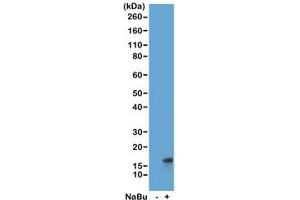 Western blot of acid extracts from HeLa cells untreated (-) or treated (+) with sodium butyrate using recombinant H3K27ac antibody at 1 ug/ml showed a band of Histone H3 acetylated at Lysine 27 in treated HeLa cells. (Recombinant Histone 3 anticorps  (acLys27))