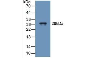 Detection of Recombinant TUBd, Mouse using Polyclonal Antibody to Tubulin Delta (TUBd) (TUBD1 anticorps  (AA 236-455))