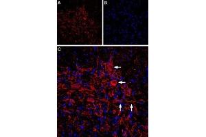 Expression of IP3R2 in rat spinal cord - Immunohistochemical staining of IP3R2 in rat spinal cord sections using Anti-IP3 Receptor-2 (ITPR2) Antibody (ABIN7043288, ABIN7044063 and ABIN7044064).