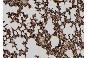 ABIN6279434 at 1/100 staining Mouse lung tissue by IHC-P. (GPATCH8 anticorps  (Internal Region))