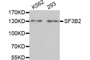Western Blotting (WB) image for anti-Splicing Factor 3b, Subunit 2, 145kDa (SF3B2) antibody (ABIN1980242) (SF3B2 anticorps)