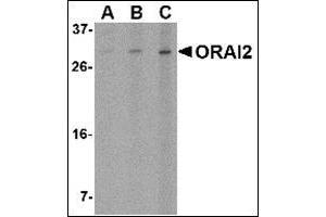 Western blot analysis of ORAI2 in Jurkat cell lysate with this product at (A) 1, (B) 2 and (C) 4 μg/ml. (ORAI2 anticorps  (C-Term))