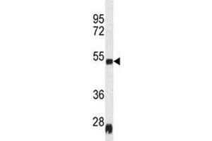 Western blot analysis of Serpinh1 antibody and rat heart tissue lysate (SERPINH1 anticorps  (AA 222-251))