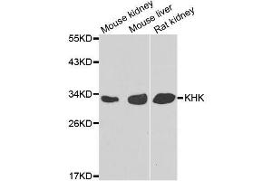 Western blot analysis of extracts of various cell lines, using KHK antibody. (Ketohexokinase anticorps  (AA 1-298))