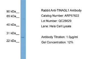 WB Suggested Anti-TINAGL1  Antibody Titration: 0. (TINAGL1 anticorps  (Middle Region))