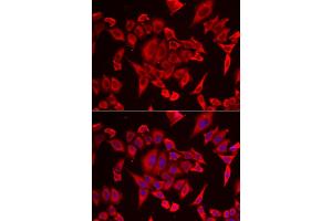 Immunofluorescence analysis of HeLa cell using SLC20A2 antibody. (SLC20A2 anticorps)