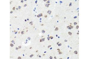 Immunohistochemistry of paraffin-embedded Mouse brain using DLG1 Polyclonal Antibody at dilution of 1:100 (40x lens). (DLG1 anticorps)