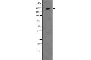 Western blot analysis of JMJD1B expression in Hela cell lysate,The lane on the left is treated with the antigen-specific peptide. (KDM3B anticorps  (Internal Region))