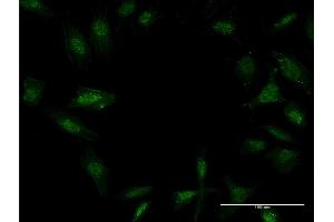 Immunofluorescence of monoclonal antibody to TWIST2 on HeLa cell. (TWIST2 anticorps  (AA 1-160))