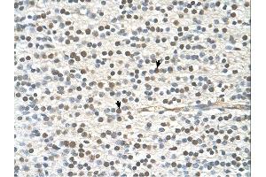 Immunohistochemistry (IHC) image for anti-GTPase Activating Protein and VPS9 Domains 1 (GAPVD1) (N-Term) antibody (ABIN2775423) (GAPVD1 anticorps  (N-Term))