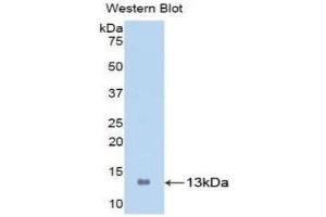 Western Blotting (WB) image for anti-S100 Calcium Binding Protein A8 (S100A8) (AA 1-93) antibody (ABIN1860487) (S100A8 anticorps  (AA 1-93))