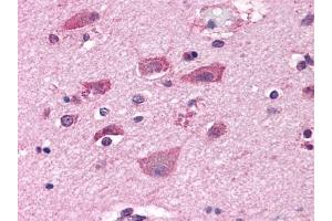 Immunohistochemical staining of Brain (Neurons and Glia) using anti- GRM7 antibody ABIN122320
