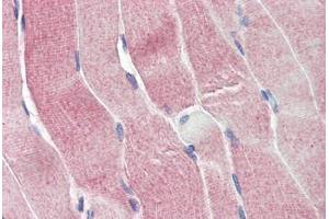 Human Skeletal Muscle (formalin-fixed, paraffin-embedded) stained with SIRT4 antibody ABIN337219 at 2. (SIRT4 anticorps  (AA 302-314))