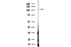 anti-Nuclear Factor Related To KappaB Binding Protein (NFRKB) antibody