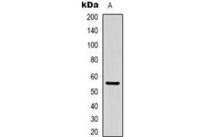 Western blot analysis of Beta-tubulin-HRP labled expression in Hela (A) whole cell lysates. (TUBB anticorps  (HRP))
