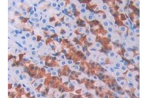 Detection of BMP6 in Rat Stomach Tissue using Polyclonal Antibody to Bone Morphogenetic Protein 6 (BMP6)