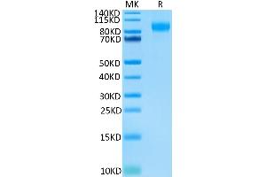 Biotinylated Human E-selectin on Tris-Bis PAGE under reduced condition. (Selectin E/CD62e Protein (His-Avi Tag,Biotin))
