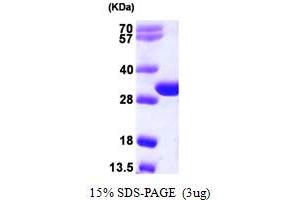three Prime Repair Exonuclease 2 (Trex2) (AA 1-236) protein (His tag)
