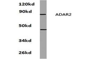 Image no. 1 for anti-Adenosine Deaminase, RNA-Specific, B1 (ADARB1) antibody (ABIN272206) (RED1 anticorps)
