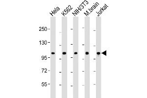 Western Blot at 1:2000 dilution Lane 1: Hela whole cell lysate Lane 2: K562 whole cell lysate Lane 3: NIH/3T3 whole cell lysate Lane 4: mouse brain lysate Lane 5: Jurkat whole cell lysate Lysates/proteins at 20 ug per lane. (DNM2 anticorps  (AA 213-247))
