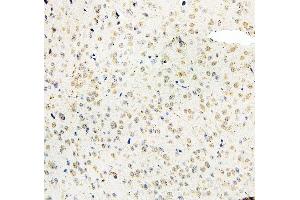 IHC analysis of MID1 using anti-MID1 antibody (ABIN6719400). (MID1 anticorps  (AA 226-278))