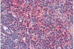 Human Thymus (formalin-fixed, paraffin-embedded) stained with PGDS antibody ABIN337149 at 10 ug/ml followed by biotinylated secondary antibody, alkaline phosphatase-streptavidin and chromogen.