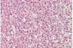 Image no. 1 for anti-Myeloid/lymphoid Or Mixed-Lineage Leukemia 2 (MLL2) (AA 2-14) antibody (ABIN1494780) (MLL2 anticorps  (AA 2-14))