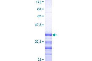 Image no. 1 for ATPase, Cu++ Transporting, beta Polypeptide (ATP7B) (AA 1372-1465) protein (GST tag) (ABIN1346157)