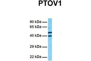 Host:  Rabbit  Target Name:  PTOV1  Sample Tissue:  Human 293T  Antibody Dilution:  1. (PTOV1 anticorps  (N-Term))