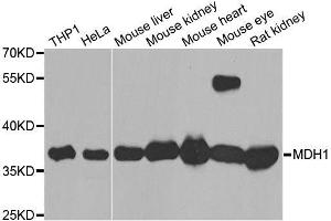 Western blot analysis of extracts of various cell lines, using MDH1 antibody. (MDH1 anticorps  (AA 1-334))